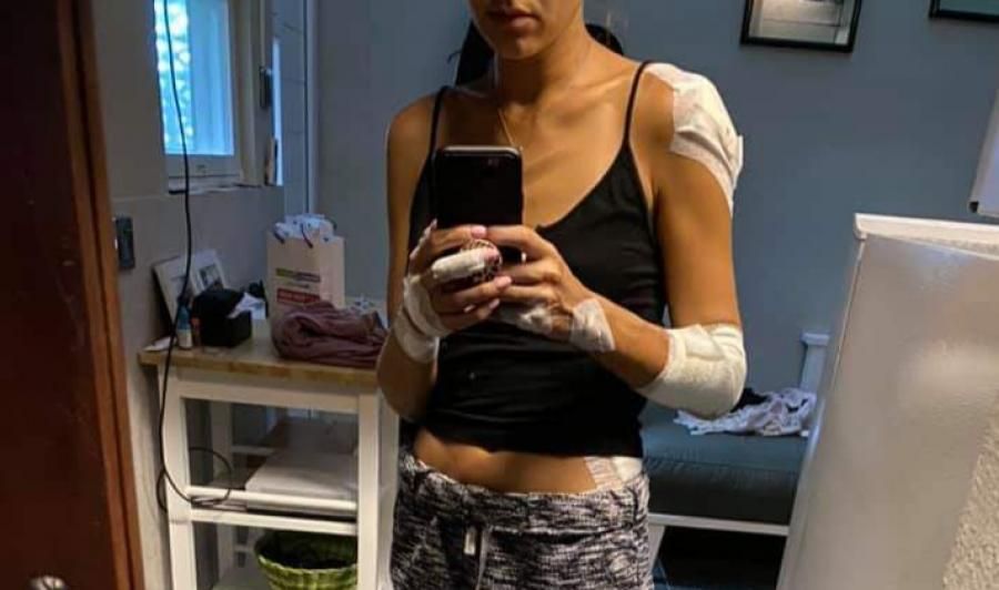 podiumnews.com-WNA Ini di Medsos Mengaku Jadi Korban Begal di Pantai Berawa