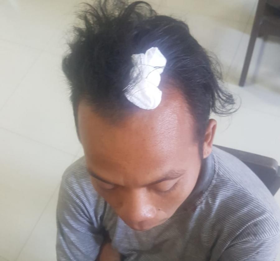 podiumnews.com-Akibat Salah Paham, Kepala Liyono Luka  Terkena Tebasan Pisau