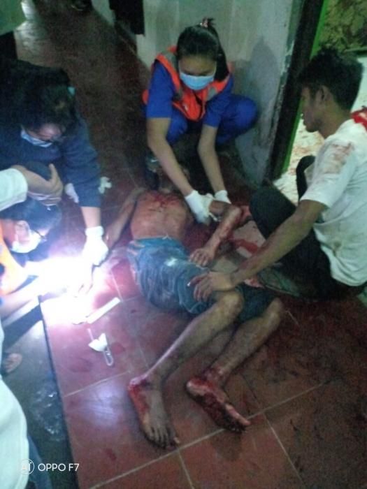 Pemuda Asal Sumbar Nyaris Tewas Dibacok Rekannya Usai Pesta Miras