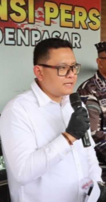 Kasatreskrim Polresta Denpasar Kompol Agus Riwayanto Diputra, S.I.K., M.H. menjelaskan kasus penganiyaan oleh dokter kepada kekasihnya. (foto/hes)