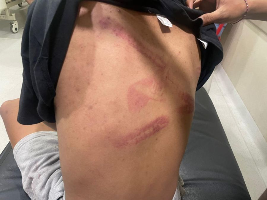 podiumnews.com-Geng Motor Liar Keroyok Remaja di Mengwi