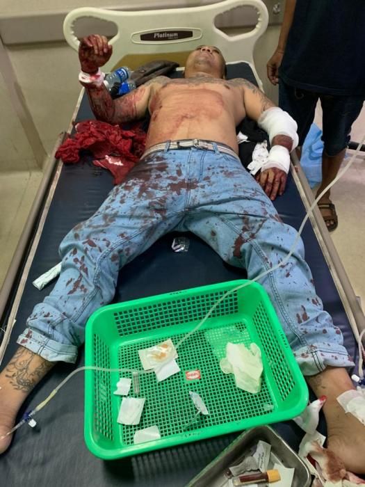 podiumnews.com-Karena Dendam, Kuncir Tebas Musuhnya Hingga Nyaris Tewas