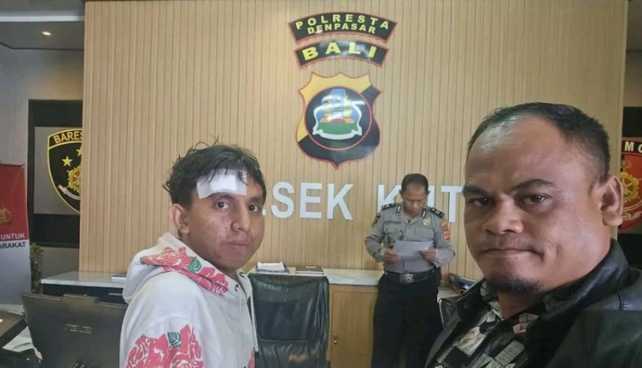 podiumnews.com-Niat Cari Kerja di Bali, Pemuda Sumba Ditipu dan Disekap