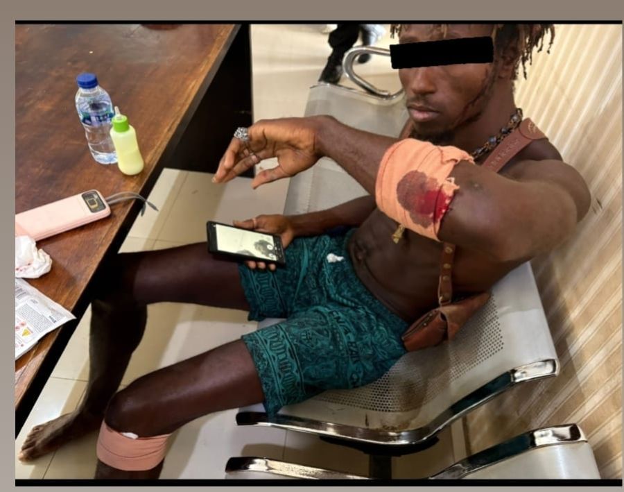 podiumnews.com-Pria Amerika Sok Jagoan, Dikeroyok Buruh Proyek di Pecatu