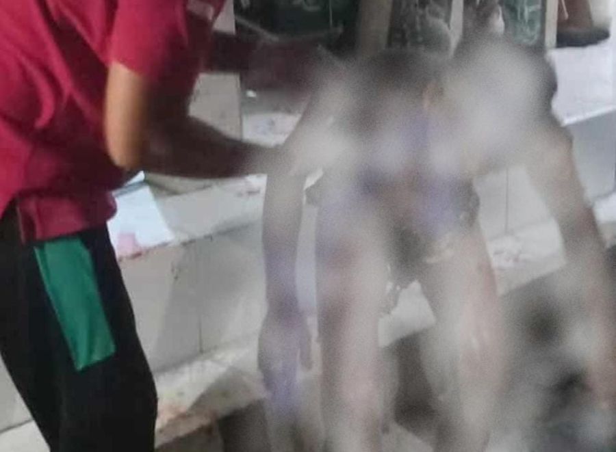 Mbadi Djaga Dewa korban luka bakar akibat tabung gas meledak di kamar kosnya di Jalan Gang Bandeng, Pemogan, Denpasar Selatan, Denpasar, Bali, Minggu (16/11/2025) malam. (foto/hes)