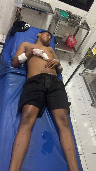 podiumnews.com-Tegur Bocah Main Petasan, Kristuanus Ditusuk Tombak di Denpasar