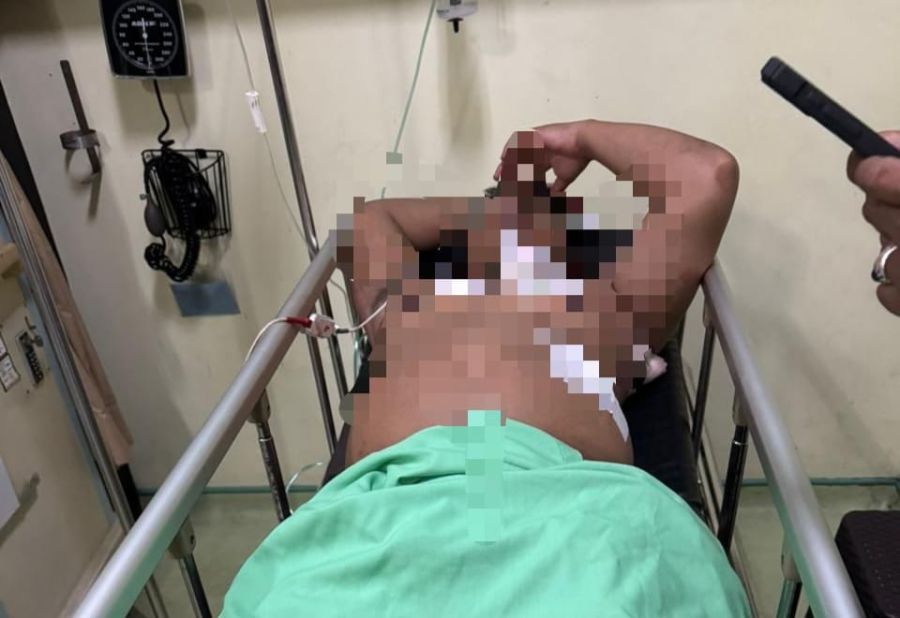 I Made DA terpaksa dilarikan ke Rumah Sakit Balimed, Denpasar, Bali, setelah mengalami sejumlah luka tusuk. (foto/hes)