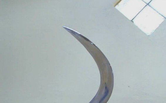 podiumnews.com-Tersinggung, Pria di Tabanan Ini Nyaris Tewas Kena Celurit