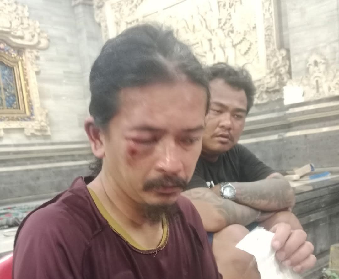 podiumnews.com-Buang Sampah Sembarangan, Reza Dikroyok