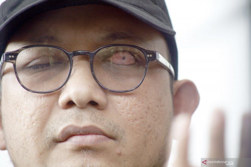 podiumnews.com-Penyidik KPK Novel Baswedan Positif COVID-19