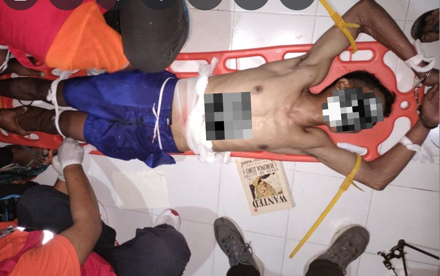 podiumnews.com-Diduga Dipicu Masalah Asmara, Pria di Denpasar Tusuk Perut Sendiri