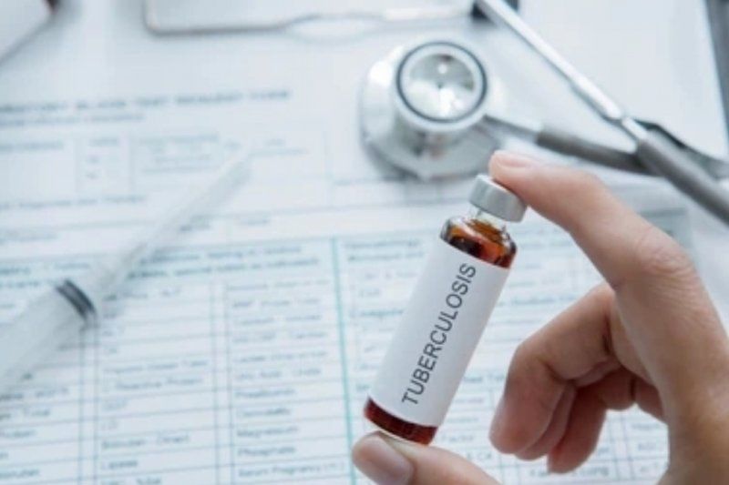 podiumnews.com-Mengenal TBC Resisten Obat dan Kendala Penanganan