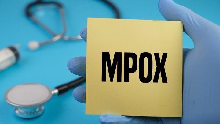 podiumnews.com-Mpox Butuh Pengobatan, Bukan Sekedar Istirahat